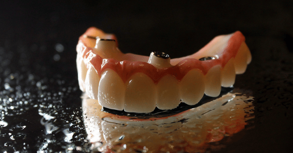 implant dentist Chattanooga - Ooltewah - Collegedale sc