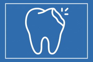 cosmetic bonding