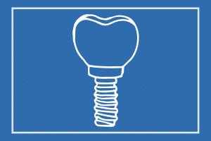 Implant Crown Restoration