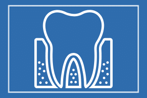 Periodontal Gum Treatment