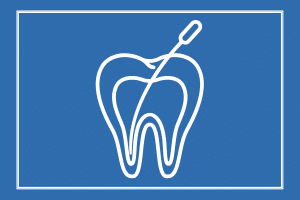 root canal