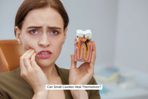 Can Small Cavities Heal Themselves