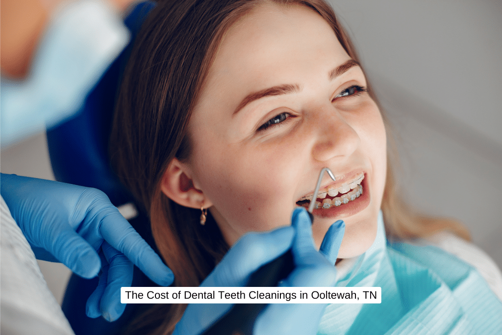 The Cost of Dental Teeth Cleanings in Ooltewah, TN