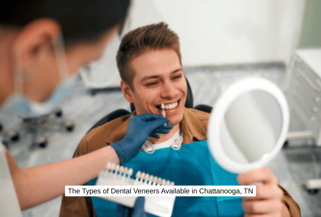 The Types of Dental Veneers Available in Chattanooga, TN